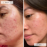 https://cdn.shopify.com/s/files/1/0482/6736/2466/files/Clear_BA_5_554fbeb7-b462-462a-bf8d-24fa7eb6c0be.jpg?v=1773694878
