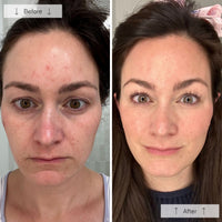 https://cdn.shopify.com/s/files/1/0482/6736/2466/files/Contour_Face_BA_1.jpg?v=1766847287