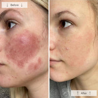https://cdn.shopify.com/s/files/1/0482/6736/2466/files/Contour_Face_BA_2.jpg?v=1766847287