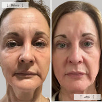 https://cdn.shopify.com/s/files/1/0482/6736/2466/files/Contour_Face_BA_3.jpg?v=1766847287