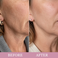 MelloNest Neck Wrinkle Eraser Gua Sha Cream 5% Anemarrhena PDRN